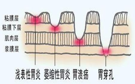 Case Sharing-Chronic Enteritis in Canines and Felines(图16)